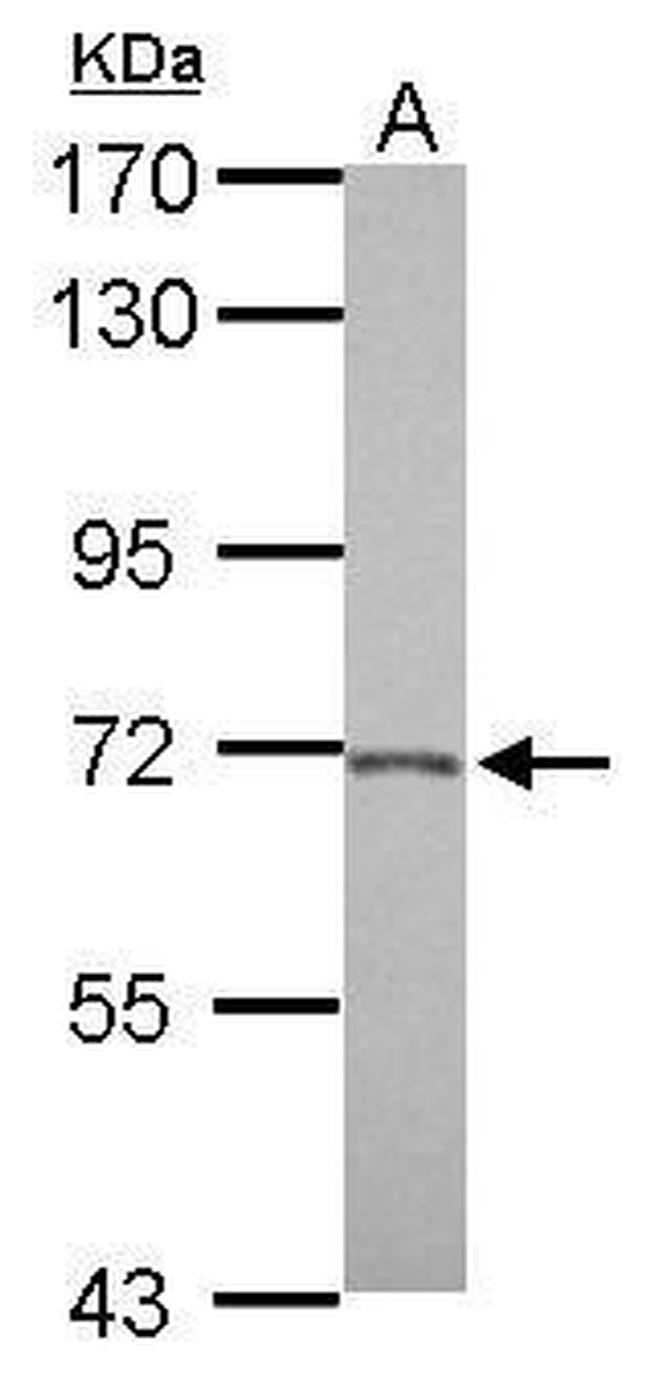 BACE2 Antibody in Western Blot (WB)