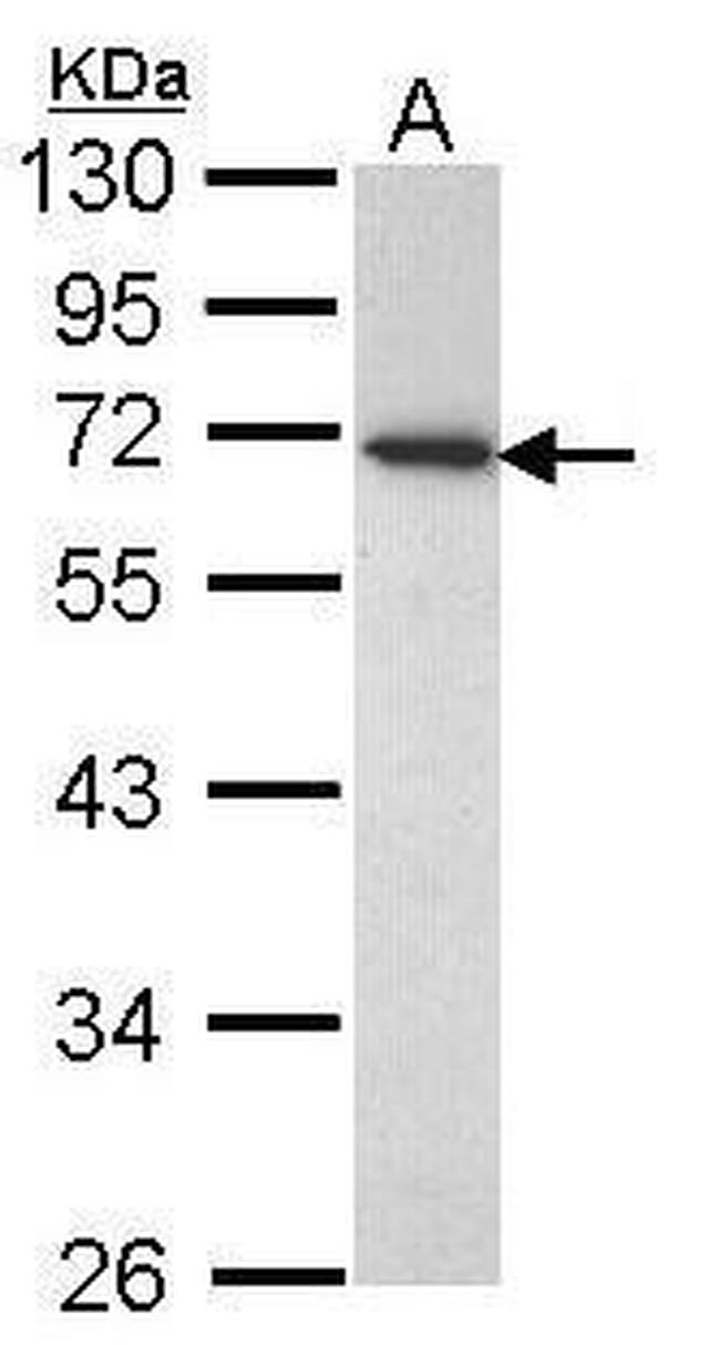 CD177 Antibody in Western Blot (WB)