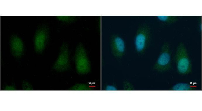 BMI-1 Antibody in Immunocytochemistry (ICC/IF)