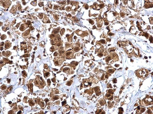 BMI-1 Antibody in Immunohistochemistry (Paraffin) (IHC (P))