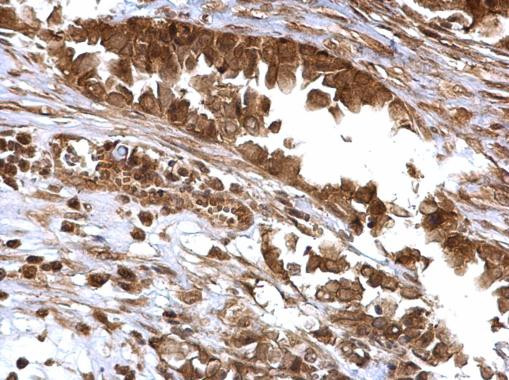 BMI-1 Antibody in Immunohistochemistry (Paraffin) (IHC (P))