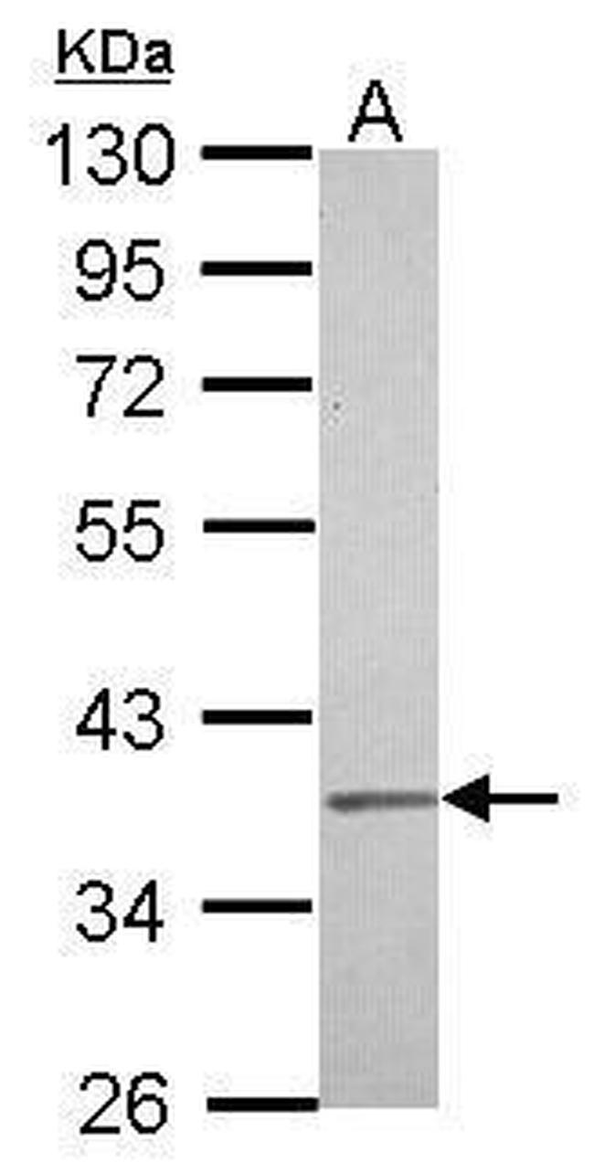 IGBP1 Antibody in Western Blot (WB)