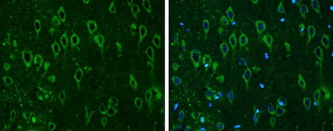 COMT Antibody in Immunohistochemistry (Paraffin) (IHC (P))