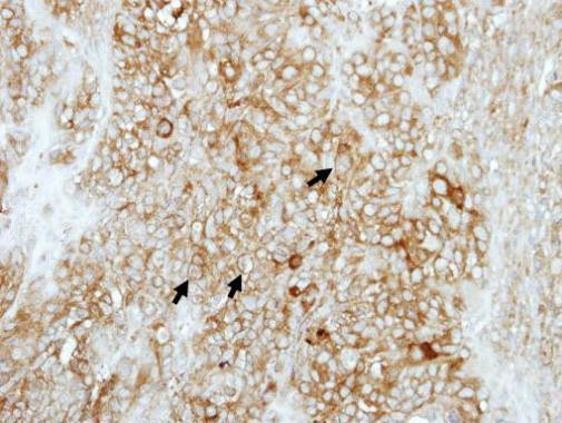 COMT Antibody in Immunohistochemistry (Paraffin) (IHC (P))