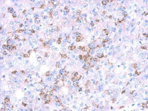 CYP27A1 Antibody in Immunohistochemistry (Paraffin) (IHC (P))