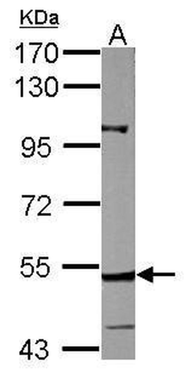 CYP27A1 Antibody in Western Blot (WB)