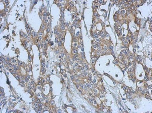 EphA3 Antibody in Immunohistochemistry (Paraffin) (IHC (P))