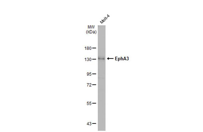 EphA3 Antibody in Western Blot (WB)