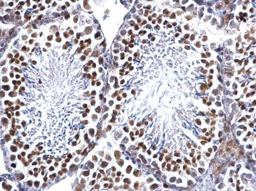 EWSR1 Antibody in Immunohistochemistry (Paraffin) (IHC (P))