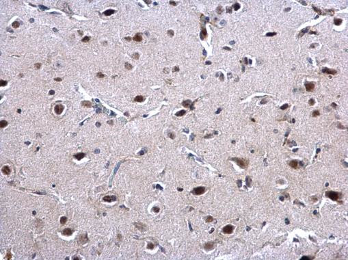 EWSR1 Antibody in Immunohistochemistry (Paraffin) (IHC (P))