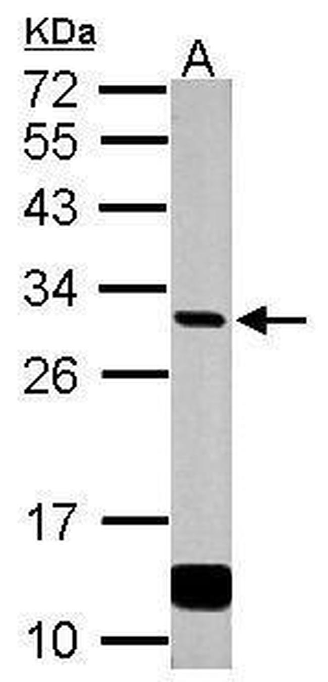 GCLM Antibody in Western Blot (WB)