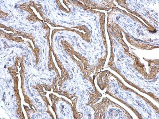 Gelsolin Antibody in Immunohistochemistry (Paraffin) (IHC (P))