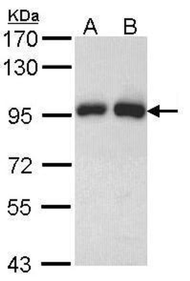 Gelsolin Antibody in Western Blot (WB)