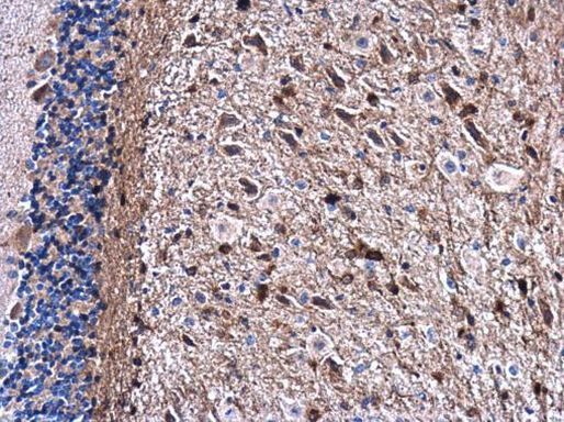 Gelsolin Antibody in Immunohistochemistry (Paraffin) (IHC (P))