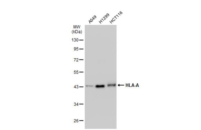 HLA-A Antibody in Western Blot (WB)