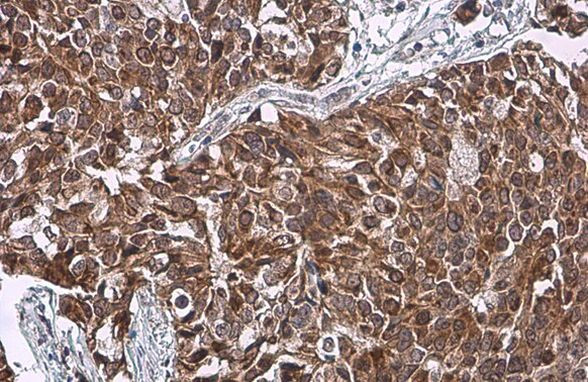 HSD3B1 Antibody in Immunohistochemistry (Paraffin) (IHC (P))