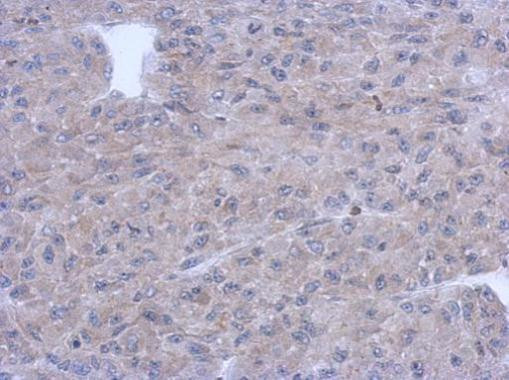 PNMT Antibody in Immunohistochemistry (Paraffin) (IHC (P))