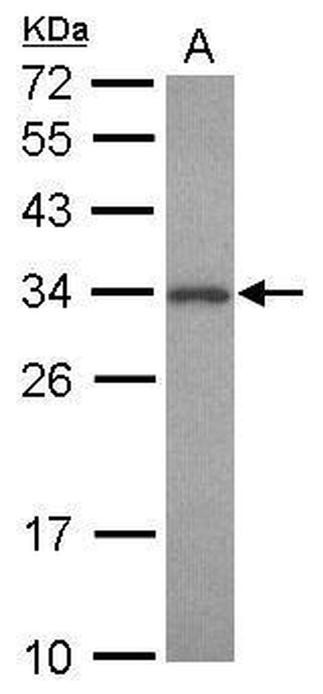 PNMT Antibody in Western Blot (WB)