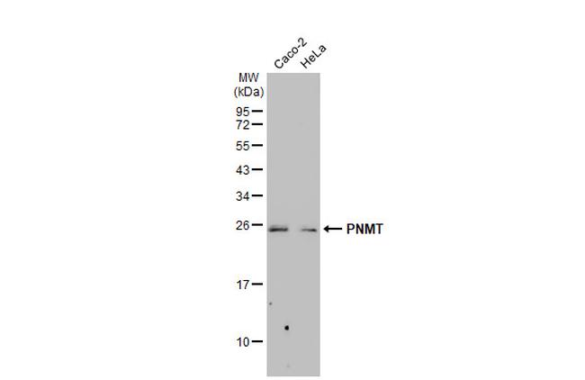 PNMT Antibody in Western Blot (WB)