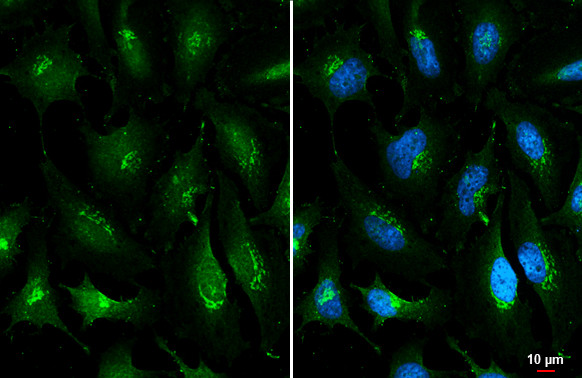 ROBO1 Antibody in Immunocytochemistry (ICC/IF)