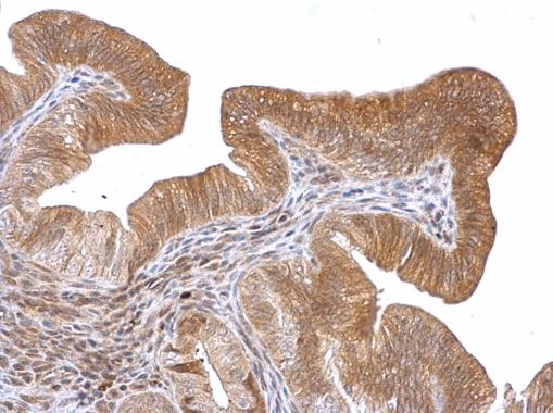 ROBO1 Antibody in Immunohistochemistry (Paraffin) (IHC (P))