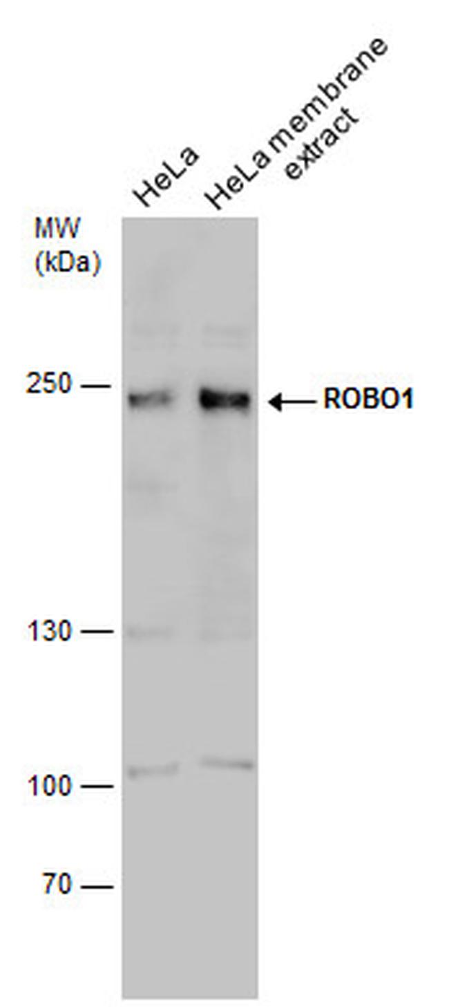 ROBO1 Antibody in Western Blot (WB)