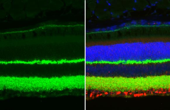 Synaptotagmin 1 Antibody in Immunohistochemistry (Paraffin) (IHC (P))