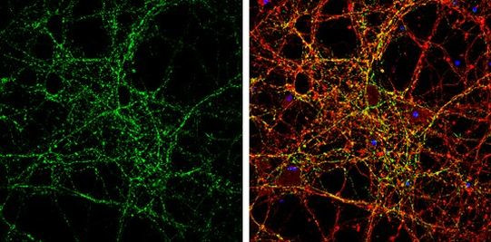 Synaptotagmin 1 Antibody in Immunocytochemistry (ICC/IF)