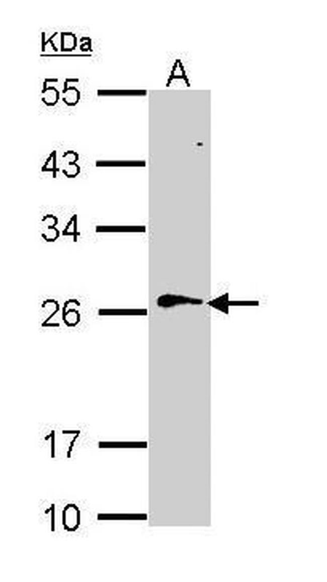 RAN Antibody in Western Blot (WB)