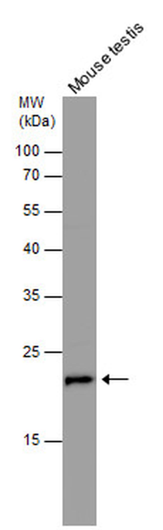 RAN Antibody in Western Blot (WB)