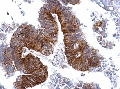 gamma Catenin Antibody in Immunohistochemistry (Paraffin) (IHC (P))