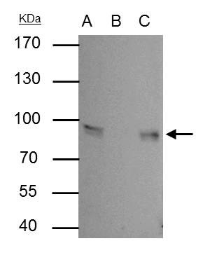 gamma Catenin Antibody in Immunoprecipitation (IP)