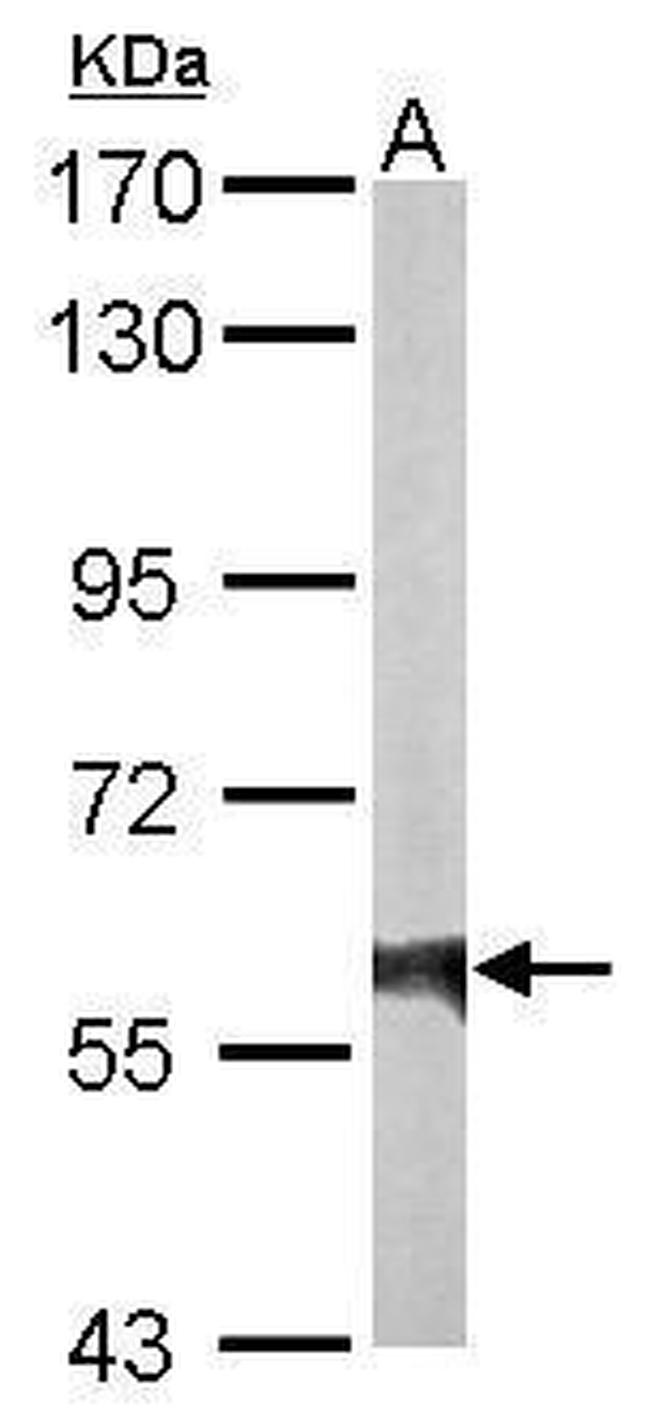 Rhotekin Antibody in Western Blot (WB)