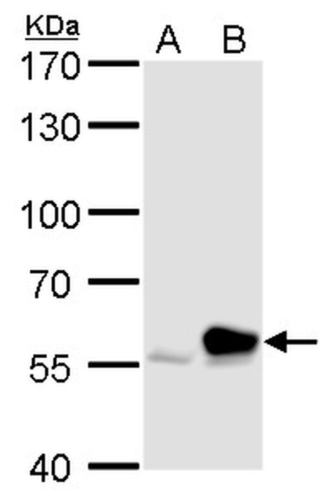 Rhotekin Antibody in Western Blot (WB)