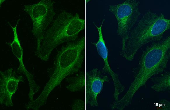 ATP6IP2 Antibody in Immunocytochemistry (ICC/IF)