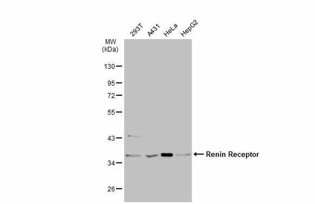 ATP6IP2 Antibody in Western Blot (WB)