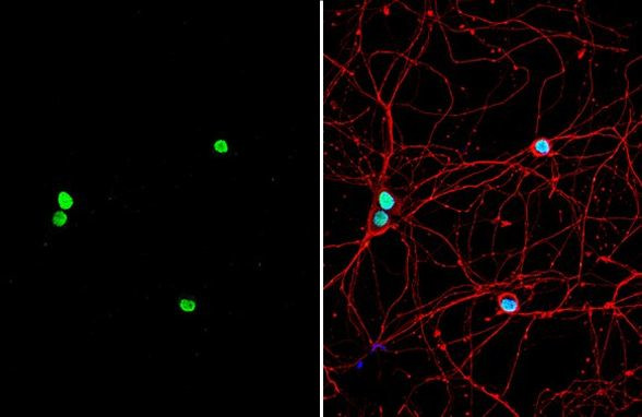 PUM2 Antibody in Immunocytochemistry (ICC/IF)