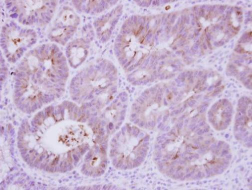 Calcineurin B Antibody in Immunohistochemistry (Paraffin) (IHC (P))