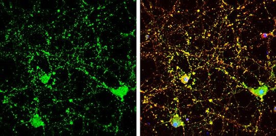 Calcineurin B Antibody in Immunocytochemistry (ICC/IF)