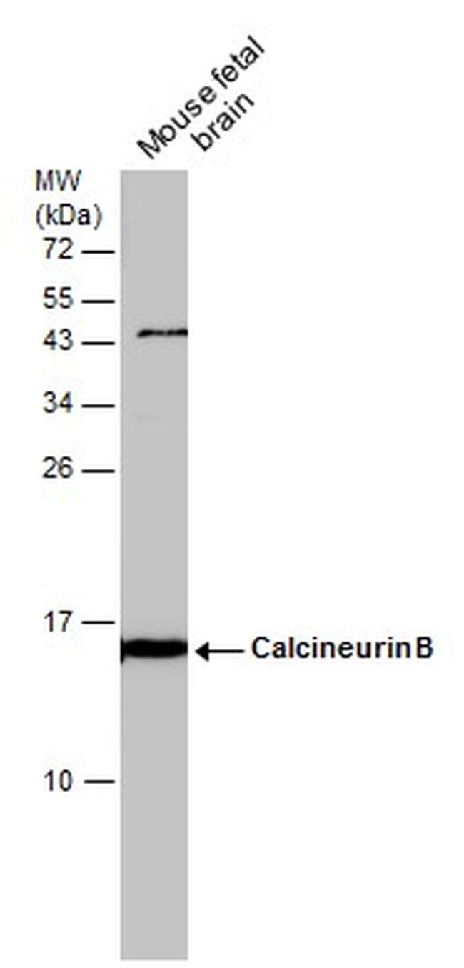 Calcineurin B Antibody in Western Blot (WB)