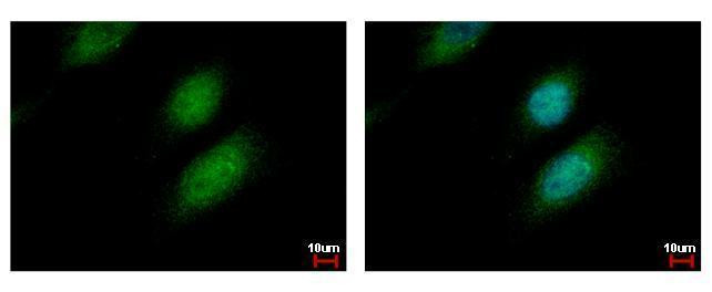 UBE2A Antibody in Immunocytochemistry (ICC/IF)