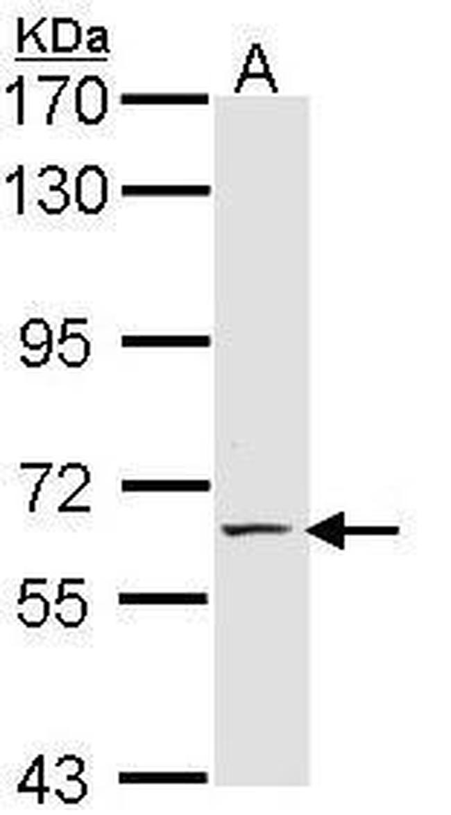 E-selectin Antibody in Western Blot (WB)