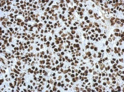 SFPQ Antibody in Immunohistochemistry (Paraffin) (IHC (P))