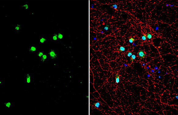 TDP-43 Antibody in Immunocytochemistry (ICC/IF)