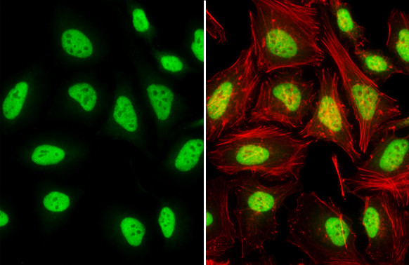 TDP-43 Antibody in Immunocytochemistry (ICC/IF)