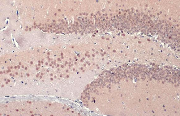 TDP-43 Antibody in Immunohistochemistry (Paraffin) (IHC (P))