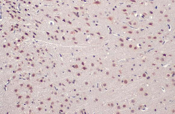 TDP-43 Antibody in Immunohistochemistry (Paraffin) (IHC (P))