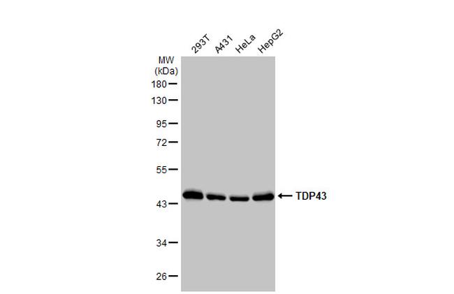 TDP-43 Antibody in Western Blot (WB)