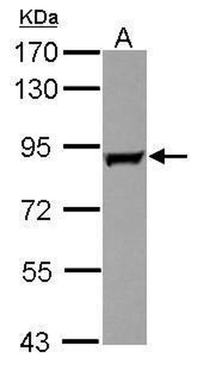 GAB2 Antibody in Western Blot (WB)