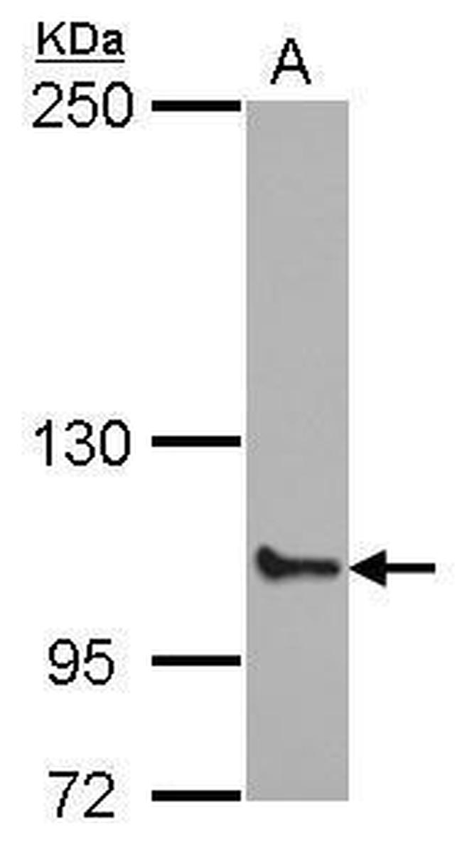 ABCF1 Antibody in Western Blot (WB)